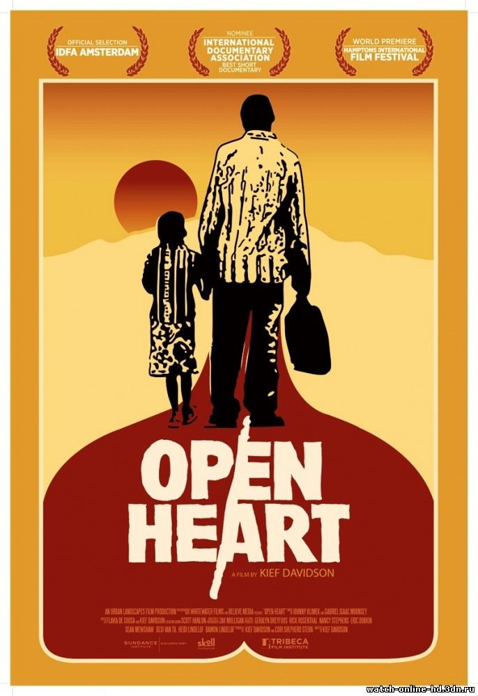 Open Heart